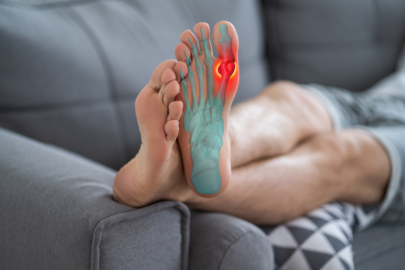 Help alleviate Bunion pain with Elite Feet USA orthotics fit by Tammy Harbison